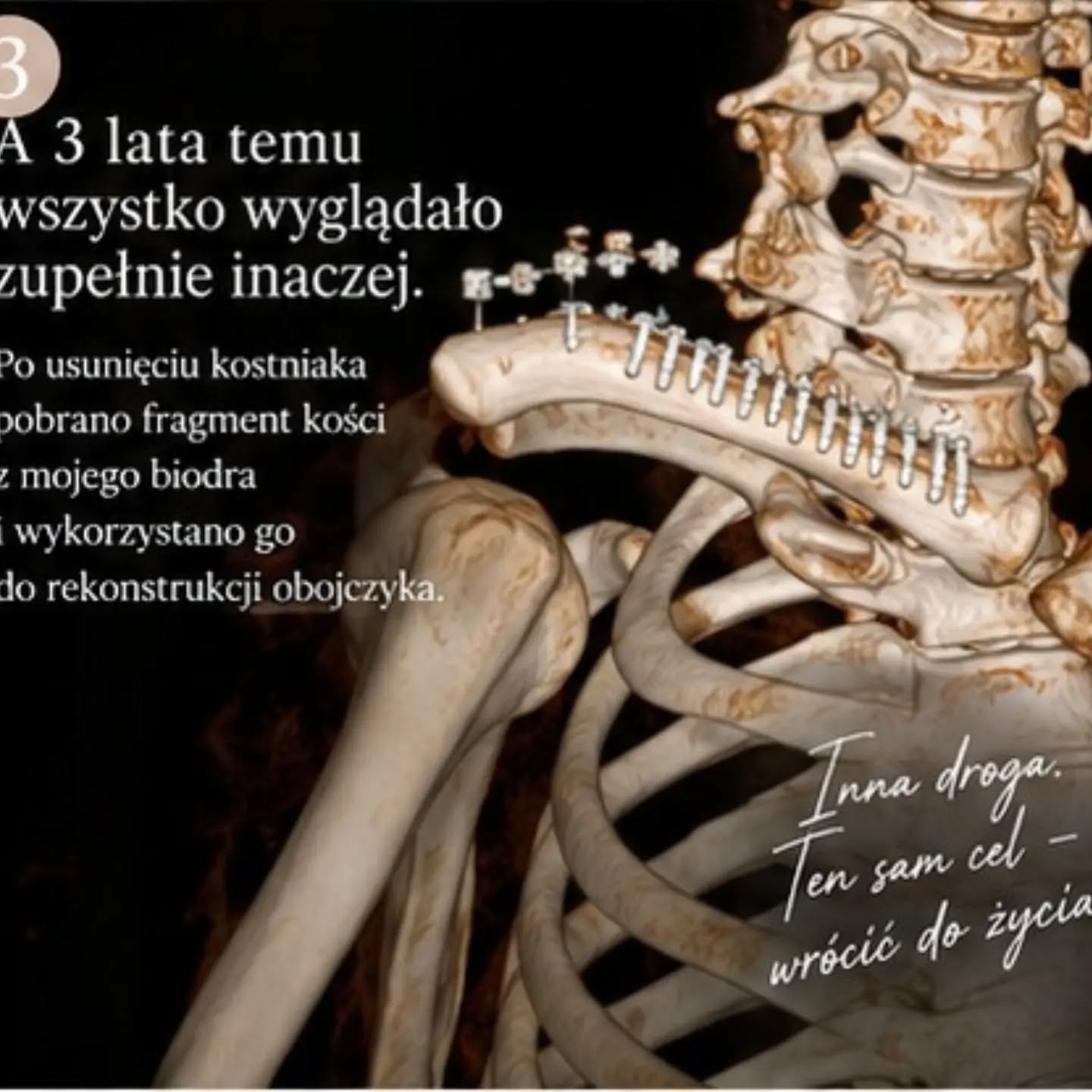 Wpis z Instagrama — 16.10.2026